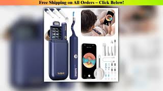 2025 New Bebird Earsight Plus I35R Ear Wax Removal Tool Camera Cleaner Kit- HD screenshot 4