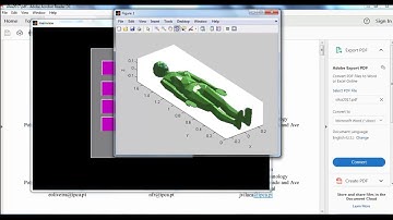 Projects on Image Processing Using Matlab | Thesis on Image Processing Using Matlab