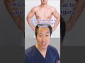 You Are The Plastic Surgeon: Gynecomastia (Manboobs) Edition! #plasticsurgeon