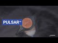 El arte de combatir las heladas - Pulsar test de prueba
