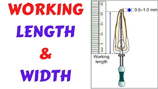 Details Endodontic Lecture- Root Canal Procedure- Working length & Working width Part 1 Guide