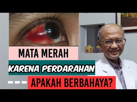 Video: Rawatan Pendarahan Di Mata Dengan Ubat-ubatan Rakyat Dan Kaedah