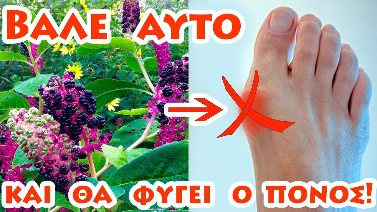 Πώς θεράπευσα την αρθρίτιδα με φυτό Φυτολάκα!!