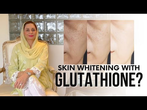 glutathione injection for melasma REVEALED: The Truth About IV Glutathione for Skin Whitening & Melasma