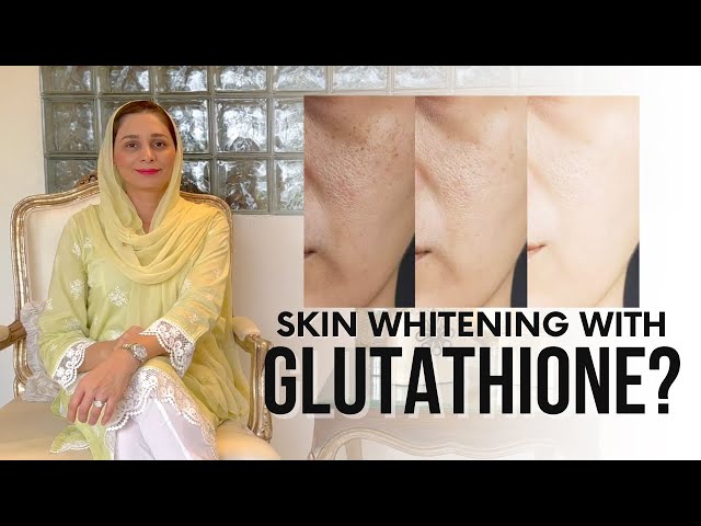REVEALED: The Truth About IV Glutathione for Skin Whitening & Melasma