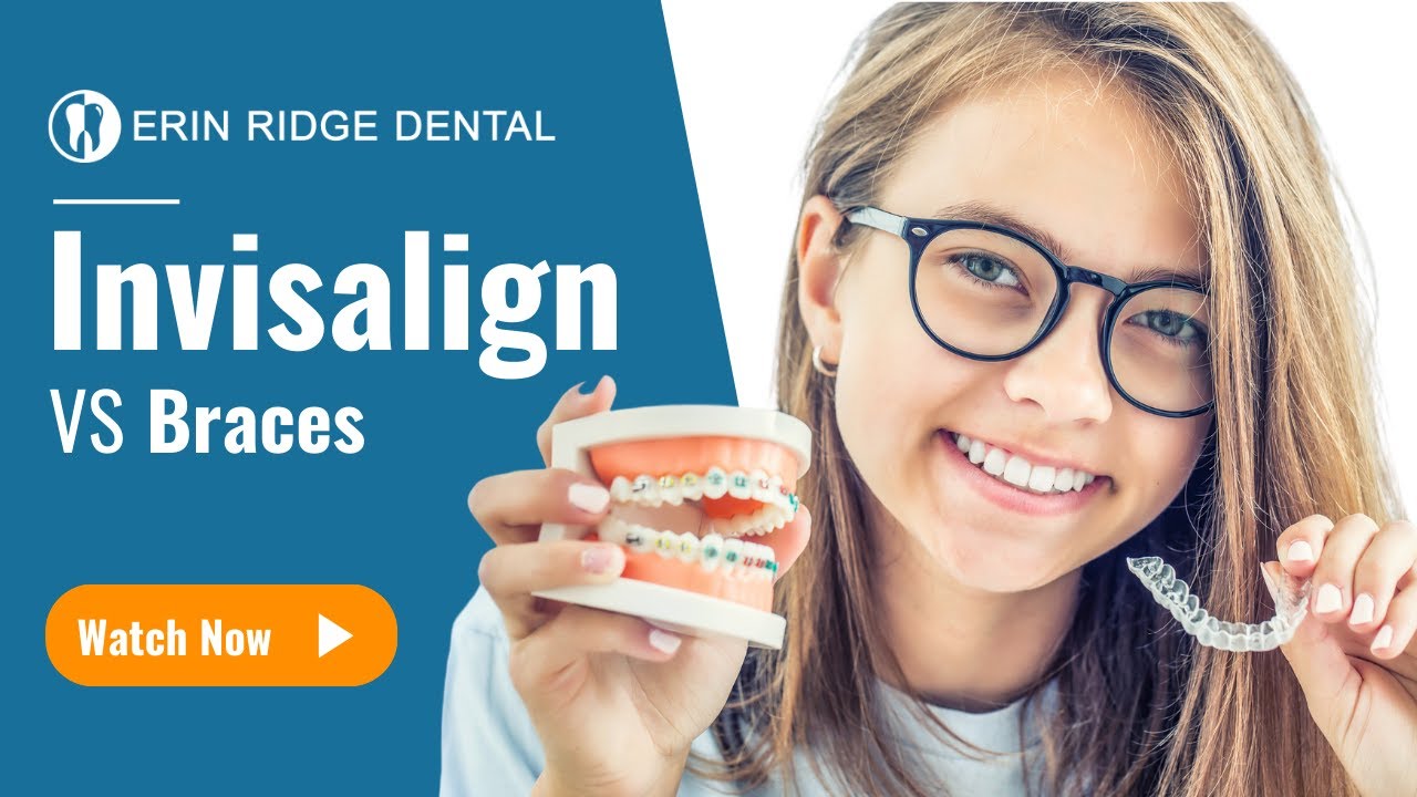 Invisalign vs Braces | Erin Ridge Dental, St. Albert Dentist - YouTube