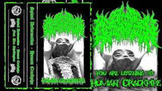Spinal Deformation - Human Crackpipe (Single) [ Slamming Brutal Death Metal ]