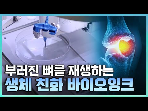   기술자들 차세대 의료 분야를 이끌어 갈 기술 YTN 사이언스