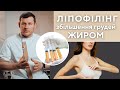 ЛІПОФІЛІНГ ГРУДЕЙ - спосіб збільшити груди без імплантів