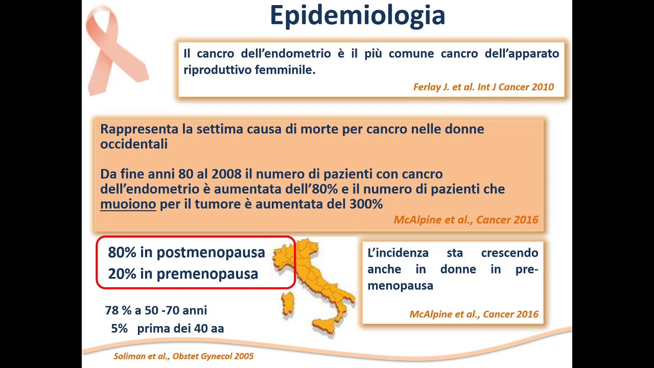 Prof Fulvio Zullo - Carcinoma dell'endometrio - YouTube