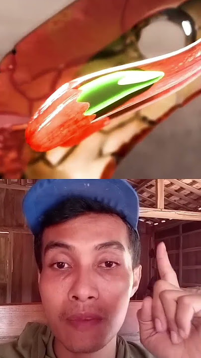 di gigit ular berbisa