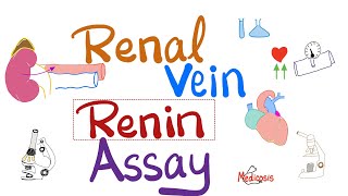 Renal vein renin assay - Hypertension and Renal artery stenosis - Nephrology