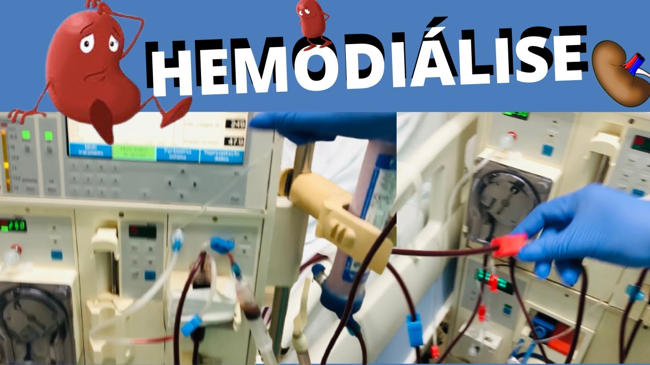 Como funciona uma MÁQUINA DE HEMODIÁLISE? APRESENTAÇÃO 