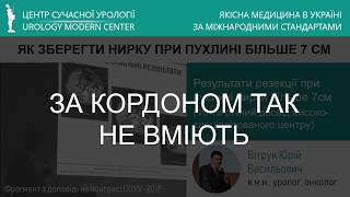 Нирка: пухлина більше 7 см - як зберегти орган! (ЗА КОРДОНОМ ТАК НЕ ВМІЮТЬ)