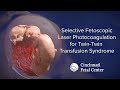Twin-Twin Transfusion Medical Animation (TTTS) | Cincinnati Fetal Center