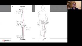 Malunion, Nonunion of the Lower and Upper Extremities, Geoffrey Marecek, M.D. | IHOGR 2026