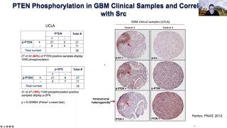 Prof Frank Furnari: Radiosensitizing glioma through disruption of PTEN nuclear function.