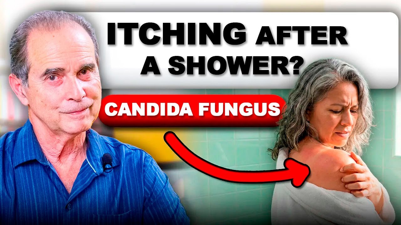 Candida Fungus Explained | Itching, Weight Gain and Slow Metabolism