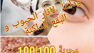 100 /100 أسهل و أسرع طريقة لازالة آثار حب الشباب و البقع الداكنة مجرررربة ومضموونة