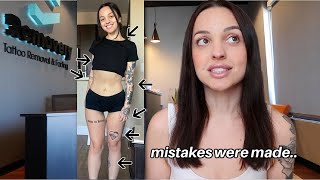 i regret getting my tattoos. ( starting my tattoo removal journey)
