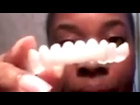 Video: Mensen Kunnen Hun Tanden In één Dag Herstellen - Alternatieve Mening