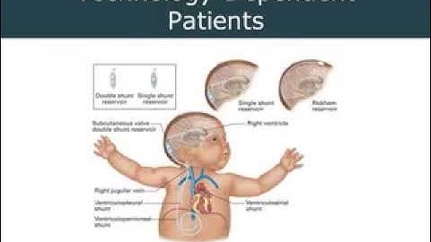 2014 03 14 13 41 AEMT Ch 46