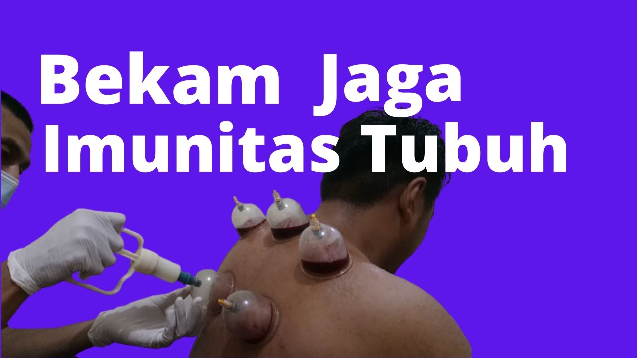 Cara Menjaga Imunitas Tubuh dengan Vitamin Alami - Blogicakicak
