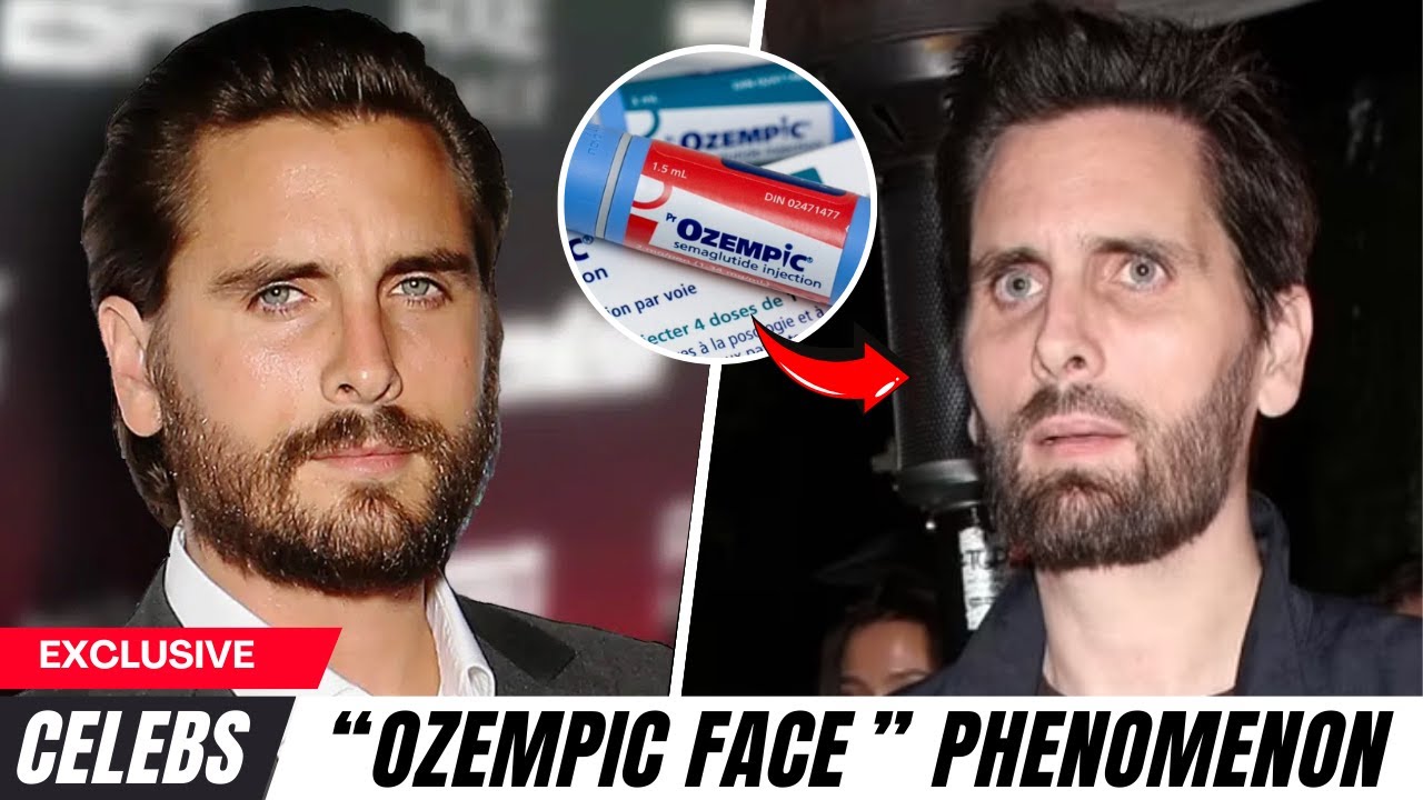 Ozempic Face Takes Hollywood by Storm The New Celebrity OBSESSION