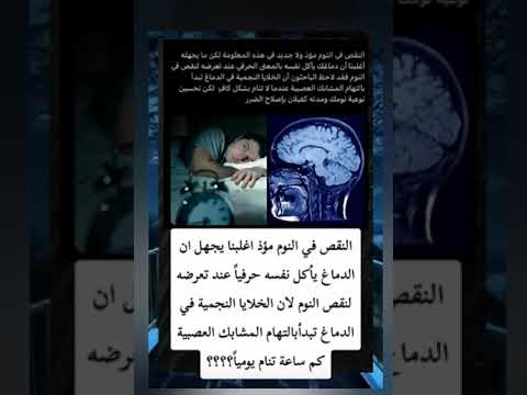 معلومات عن النقص في النوم صباح الخير