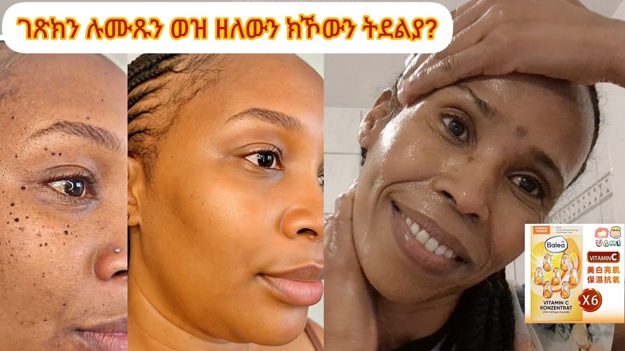 2 ክልተ ነጋራት ጥራይ የድልየና ኣነ 3 ዓመት ዝኣክል ተጥውቂመሉ ኣለኹ‼️✅️ ክትግረማ  ኢኽን ፈትነኦ ‼️✅️