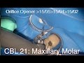 CBL 21: Maxillary First Molar