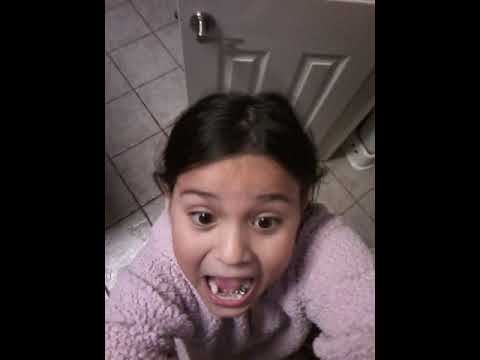 I got braces😃😃😃😃😃😄😄😆😆😉😉😊😊🤗