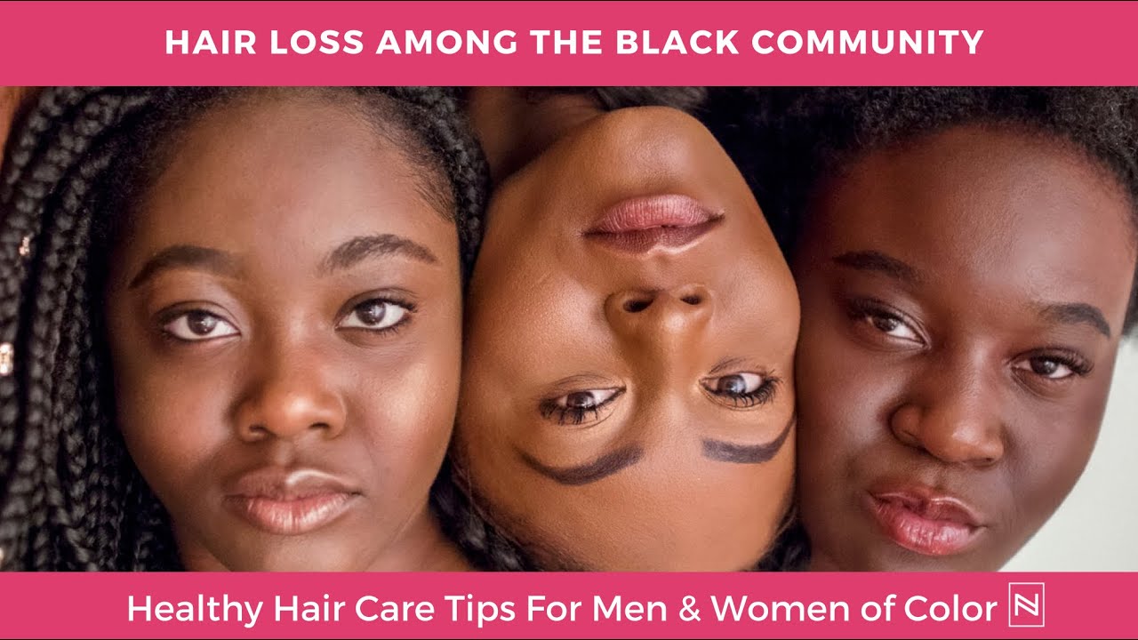 Hair Loss in Black Women, Hair Loss Treatment for Women