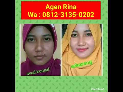 Wajah Kusam Dan Berminyak