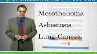 Mesothelioma Treatment Options, San Francisco, Asbestos Law