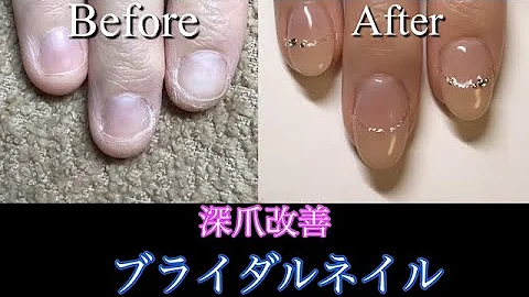 Download ブライダル ネイル 短い 爪 Mp4 Mp3