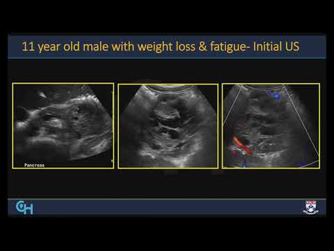 2021 Pediatric Imaging Essentials: Techniques, Pearls and Pitfalls - A CME Video Activity