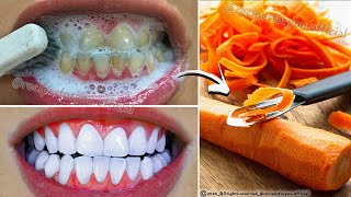 Secret that Dentists don't want you to know: Remove Tartar and Teeth Whitening in just 2 minutes🪥🥕