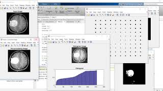 A Deep Learning Based Segmentation Method for Brain Tumor in MR Images