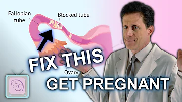 Can you naturally unclog fallopian tubes?