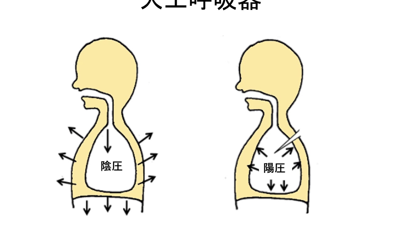 呼吸器 気胸 人工呼吸器 胸腔ドレナージ 講義 看護師国家試験対策 Youtube 呼吸器 気胸 人工呼吸器 胸腔ドレナージ 講義 看護師国家試験対策 Youtube