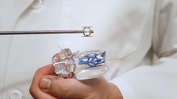 Dr. Robert Evans Heithaus Explains SpineJack