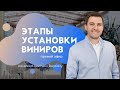 Этапы установки виниров