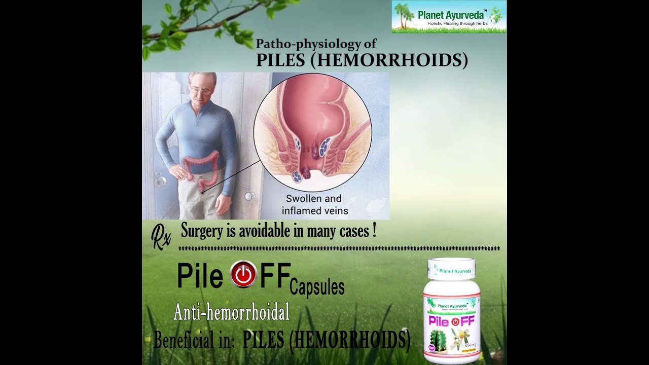 Pile OFF Capsules - Heal Hemorrhoids Naturally, Piles Treatment Without Surgery