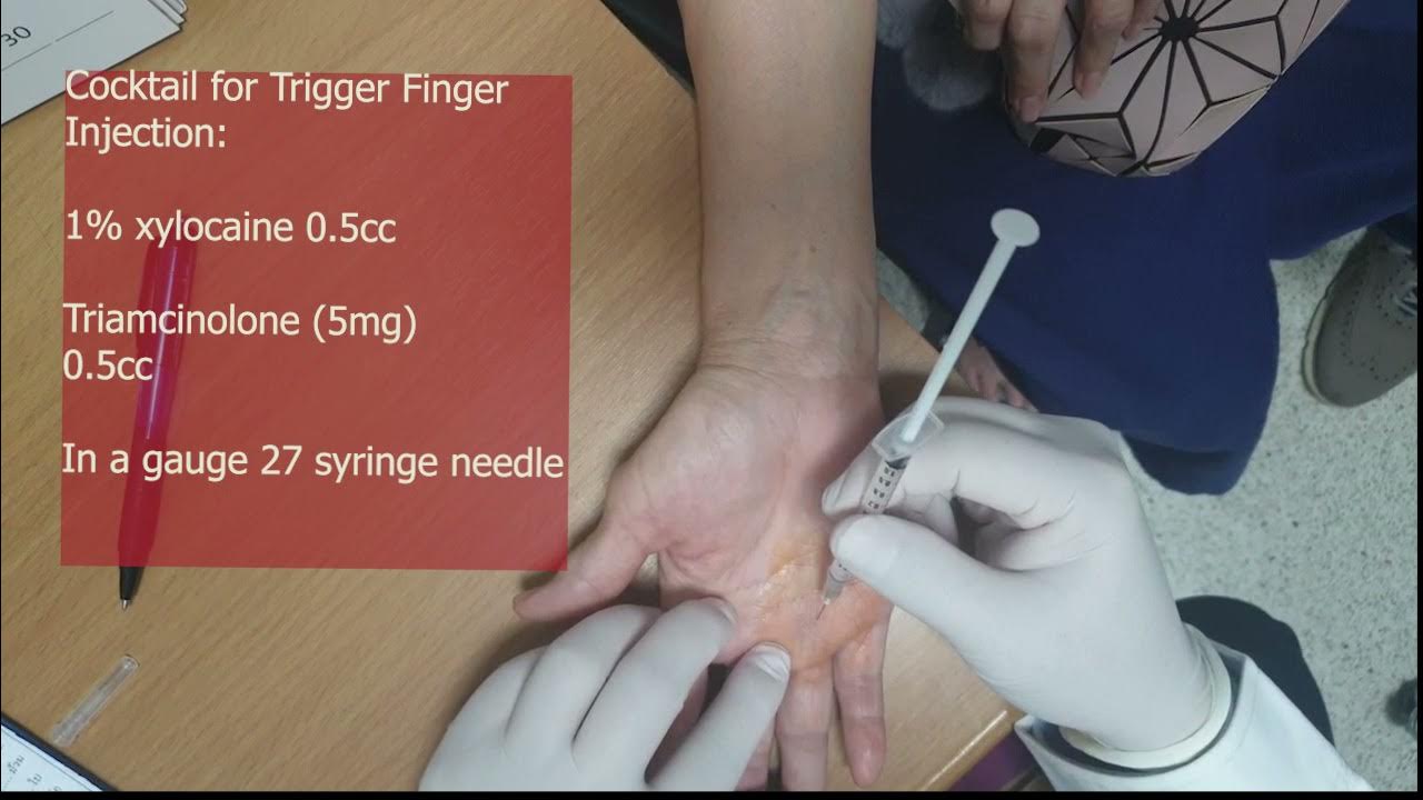 เทคนิคการฉีดสเตียรอยด์นิ้วล๊อค Steroid injection Technique in Trigger