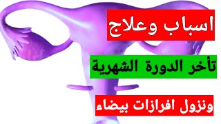 تأخر الدورة الشهرية ونزول افرازات بيضاء|اسباب تاخر وغياب الدورة والافرازات البيضاء الشفافة|البريود