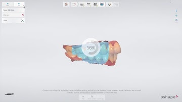 3Shape TRIOS   Patient specific motion