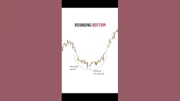 Rounding Bottom Pattern | Powerful Trend Reversal Setup