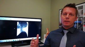 How to combat pre existing injuries with evidence