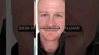 HOW TO IMPROVE FACIAL ATTRACTIVENESS